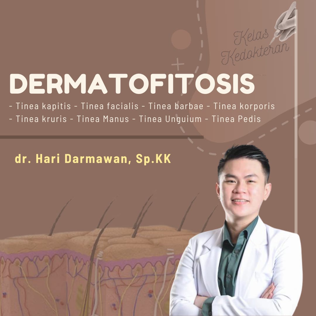 Dermatofitosis