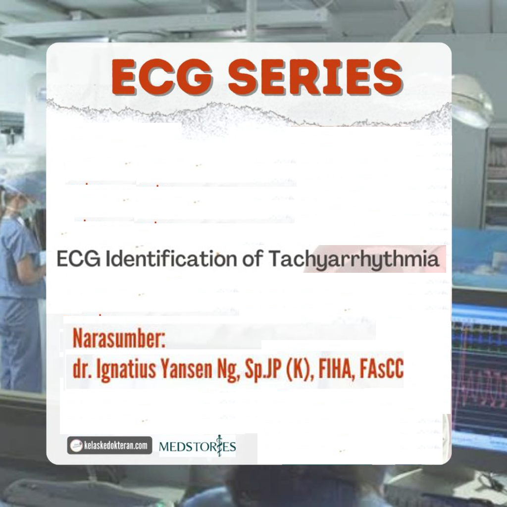 ECG Identification of Tachyarrhtyhmia